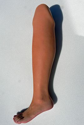 Ortopédico Marvá Cover prótesis tibial